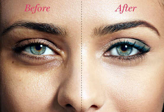 Cure dark circles in quick, effective way