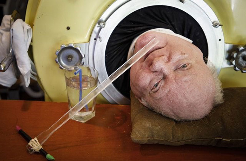 The Man in the Iron Lung Paul Alexander