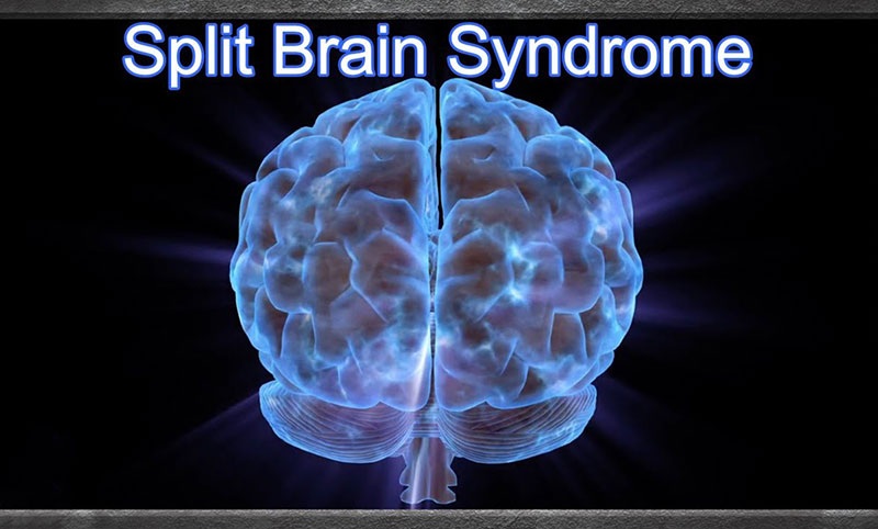 Split Brain Syndrome: Understanding the Disconnected Hemispheres of Our Brain