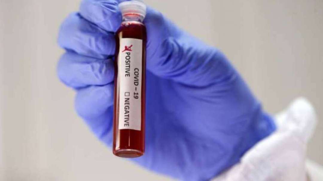 Lab in Kerala issues fake COVID-19 certificate to NRIs