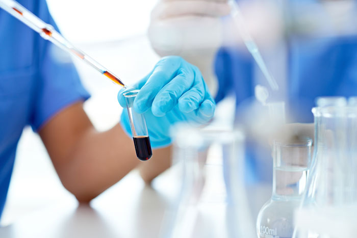 More laboratories to conduct PCR test in Kuwait